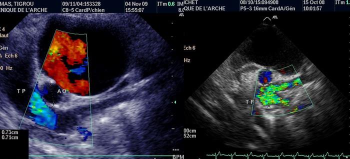 Dysplasie tricuspidienne et dilatation de l'oreillette droite chez un chat et Sténose pulmonaire chez un chien